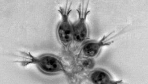 Salpingoeca sp. - Choanoflagellate. Photo: Barry S. C. Leadbeater.