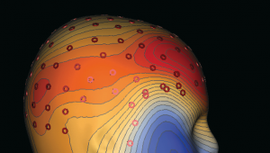 Cognitive Neuroscience of Memory